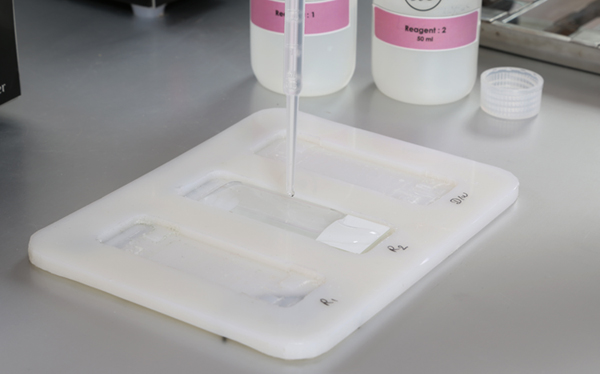 DNA Slide Staining Tray